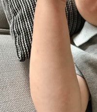 Inflammation and Hospitalisation image