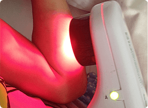 Inflammation and Hospitalisation image